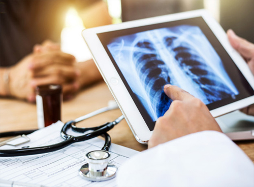 Digital X-Ray
